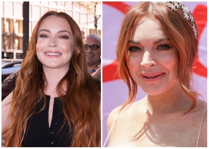 Shocking Transformations Revealed Celebrity Before And After Plastic(03)