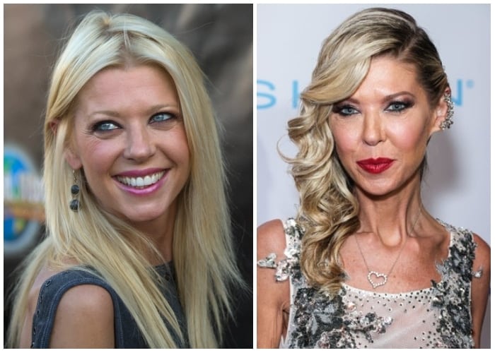 Shocking Transformations Revealed Celebrity Before And After Plastic(04)